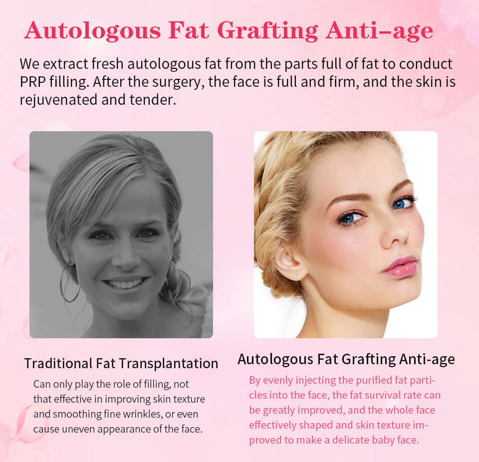 anti-aging treatments with self fat filler