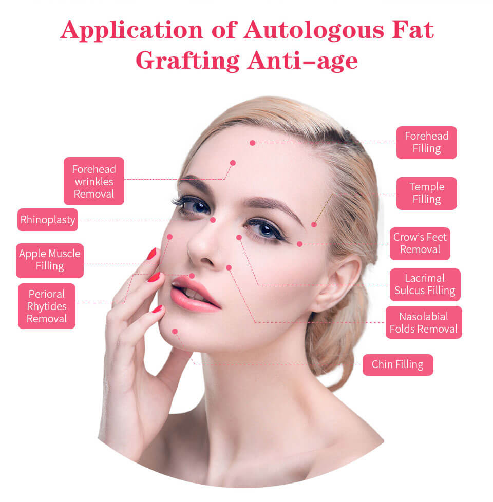 which parts on face self fat can fill